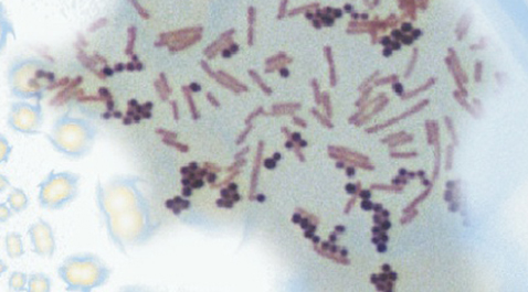 Surface Disinfection Shared